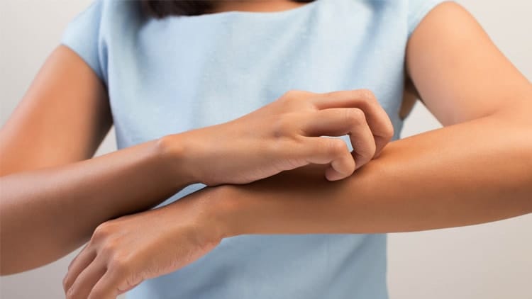 skin-allergy