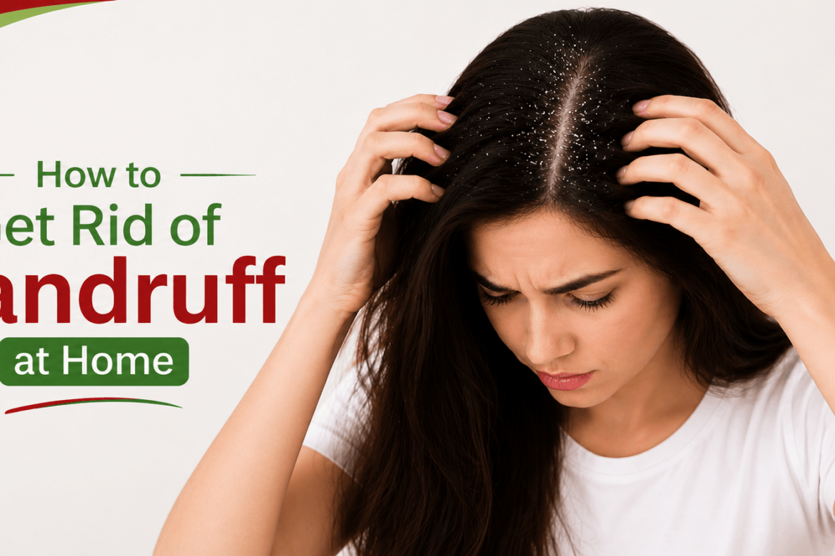 How to Get Rid of Dandruff at Home