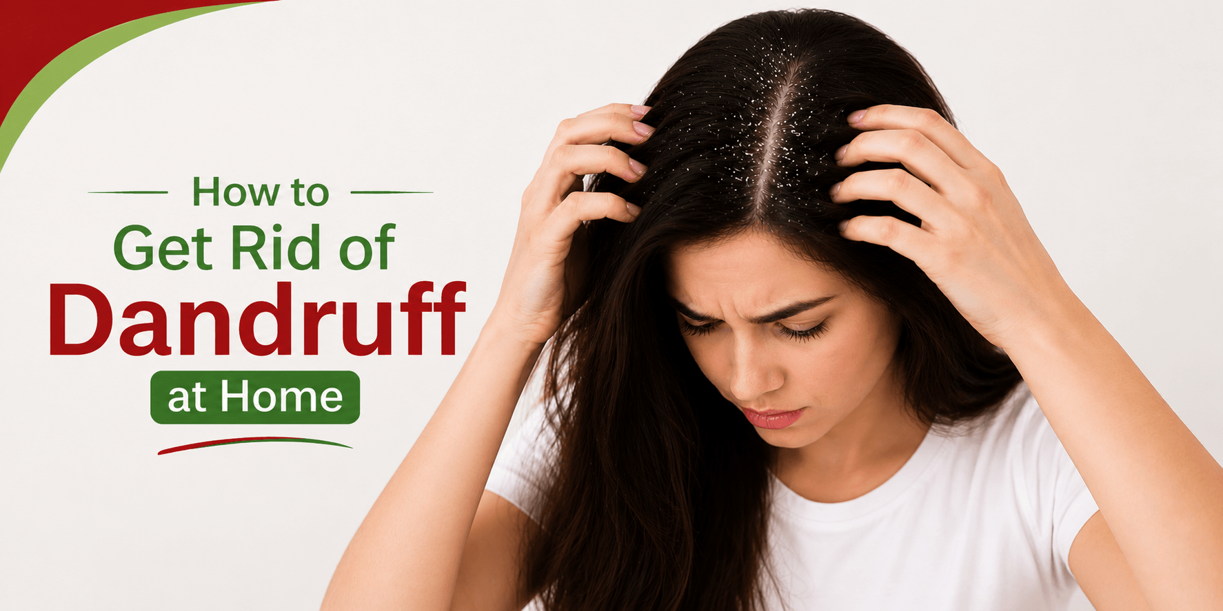 How to Get Rid of Dandruff at Home