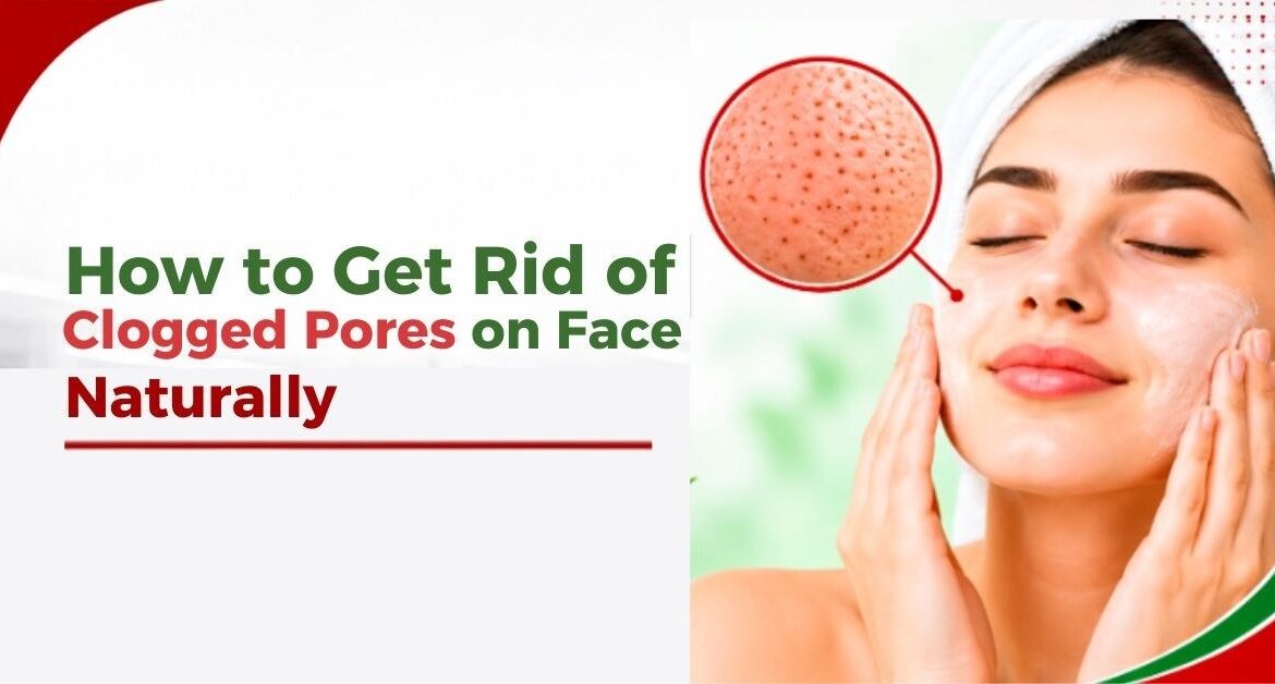 how to get rid of clogged pores on face