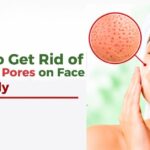 how to get rid of clogged pores on face