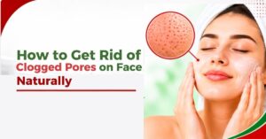 how to get rid of clogged pores on face