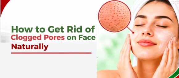 how to get rid of clogged pores on face