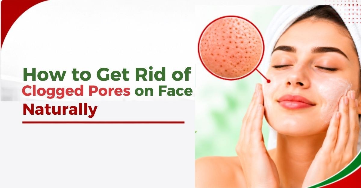 how to get rid of clogged pores on face